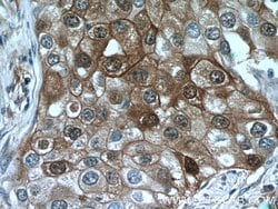 LTB4R Rabbit anti-Human, Polyclonal, Proteintech:Antibodies:Primary Antibodies