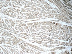 LTB4R Rabbit anti-Human, Polyclonal, Proteintech:Antibodies:Primary Antibodies