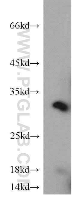 Proteintech CAPZA1 Rabbit anti-Human, Mouse, Polyclonal, Proteintech