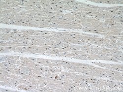 PPP3CA Rabbit anti-Human, Mouse, Polyclonal, Proteintech:Antibodies:Primary