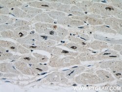 PPP3CA Rabbit anti-Human, Mouse, Polyclonal, Proteintech:Antibodies:Primary