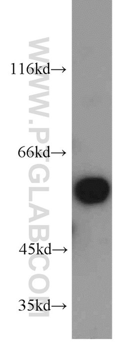 PPP3CA Rabbit anti-Human, Mouse, Polyclonal, Proteintech:Antibodies:Primary