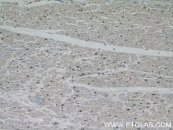 PPP3CA Rabbit anti-Human, Mouse, Polyclonal, Proteintech:Antibodies:Primary