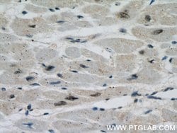 PPP3CA Rabbit anti-Human, Mouse, Polyclonal, Proteintech:Antibodies:Primary