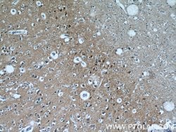 Proteintech PPP3CA Rabbit anti-Human, Mouse, Polyclonal, Proteintech