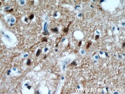 PPP3CA Rabbit anti-Human, Mouse, Polyclonal, Proteintech:Antibodies:Primary