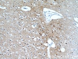 PPP3CA Rabbit anti-Human, Mouse, Polyclonal, Proteintech:Antibodies:Primary
