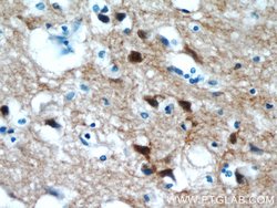 PPP3CA Rabbit anti-Human, Mouse, Polyclonal, Proteintech:Antibodies:Primary