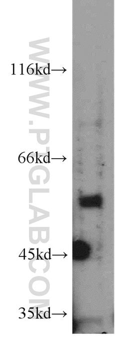 PPP3CA Rabbit anti-Human, Mouse, Polyclonal, Proteintech:Antibodies:Primary