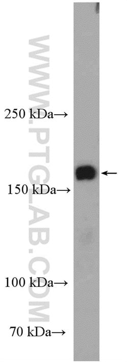 NAIP Rabbit anti-Human, Polyclonal, Proteintech 150 &mu;L | Buy Online | Proteintech Group Inc | Fisher Scientific