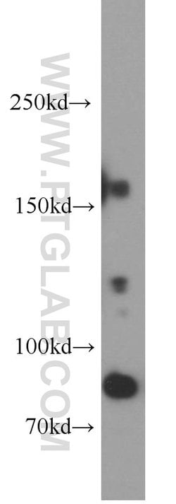 ARHGAP5 Rabbit anti-Human, Mouse, Rat, Polyclonal, Proteintech 20 &mu;L;