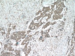 SMURF1 Rabbit anti-Human, Mouse, Rat, Polyclonal, Proteintech:Antibodies:Primary