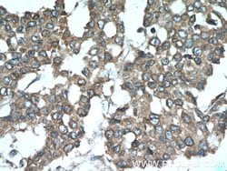 SMURF1 Rabbit anti-Human, Mouse, Rat, Polyclonal, Proteintech:Antibodies:Primary