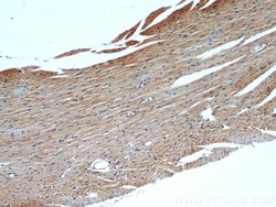 ATP1A2 Rabbit anti-Human, Mouse, Polyclonal, Proteintech:Antibodies:Primary