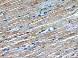ATP1A2 Rabbit anti-Human, Mouse, Polyclonal, Proteintech:Antibodies:Primary