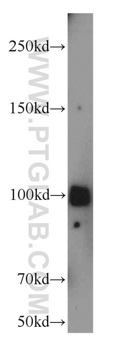 ATP1A2 Rabbit anti-Human, Mouse, Polyclonal, Proteintech:Antibodies:Primary