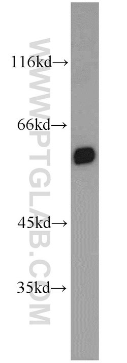 PTBP1 Rabbit anti-Human, Mouse, Polyclonal, Proteintech 150 &mu;L; Unconjugated:Antikörper