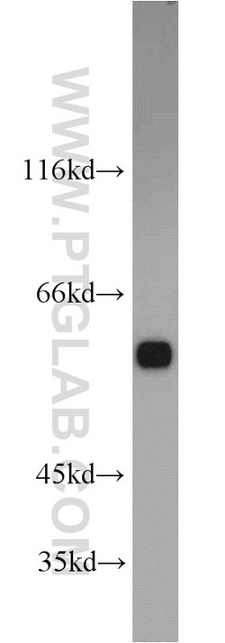 PTBP1 Rabbit anti-Human, Mouse, Polyclonal, Proteintech 150 &mu;L; Unconjugated:Antikörper