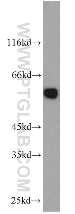 PTBP1 Rabbit anti-Human, Mouse, Polyclonal, Proteintech 150 &mu;L; Unconjugated:Antikörper