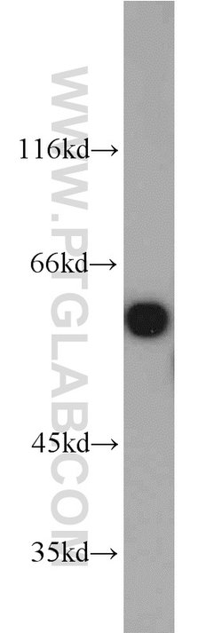 PTBP1 Rabbit anti-Human, Mouse, Polyclonal, Proteintech 150 &mu;L; Unconjugated:Antikörper