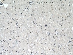p150 glued Rabbit anti-Canine, Human, Mouse, Rat, Polyclonal, Proteintech