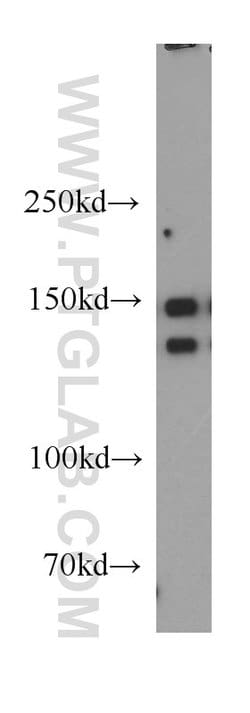 p150 glued Rabbit anti-Canine, Human, Mouse, Rat, Polyclonal, Proteintech