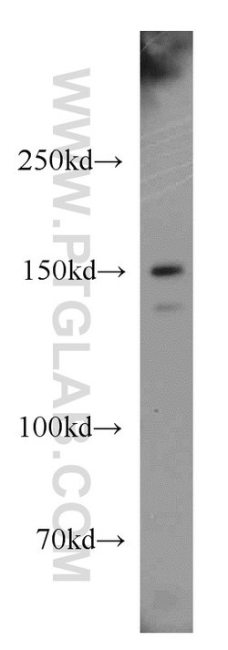 p150 glued Rabbit anti-Canine, Human, Mouse, Rat, Polyclonal, Proteintech