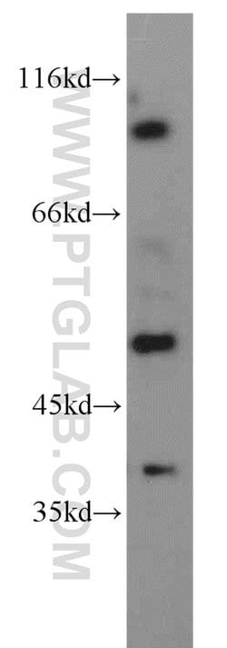 PDE6C Rabbit anti-Human, Polyclonal, Proteintech:Antibodies:Primary Antibodies