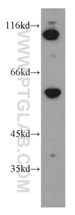 EWS Rabbit anti-Human, Mouse, Rat, Polyclonal, Proteintech 150 &mu;L; Unconjugated:Antibodies,