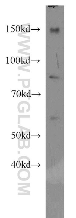EWS Rabbit anti-Human, Mouse, Rat, Polyclonal, Proteintech 150 &mu;L; Unconjugated:Antibodies,