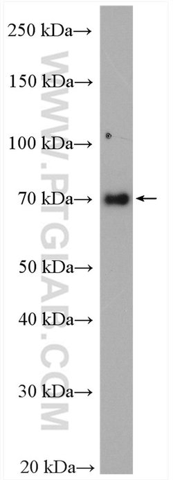 EWS Rabbit anti-Human, Mouse, Rat, Polyclonal, Proteintech 150 &mu;L; Unconjugated:Antibodies,