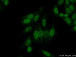 CPSF7 Rabbit anti-Human, Mouse, Rat, Polyclonal, Proteintech:Antibodies:Primary