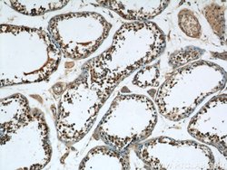 CPSF7 Rabbit anti-Human, Mouse, Rat, Polyclonal, Proteintech:Antibodies:Primary