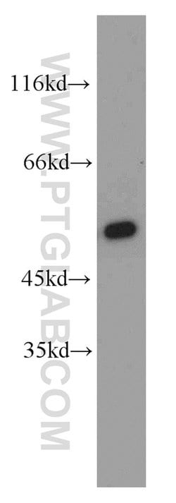 CPSF7 Rabbit anti-Human, Mouse, Rat, Polyclonal, Proteintech:Antibodies:Primary