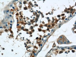 CPSF7 Rabbit anti-Human, Mouse, Rat, Polyclonal, Proteintech:Antibodies:Primary
