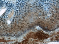 CPSF7 Rabbit anti-Human, Mouse, Rat, Polyclonal, Proteintech:Antibodies:Primary