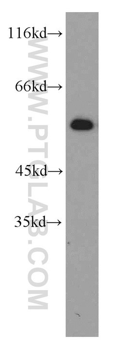CPSF7 Rabbit anti-Human, Mouse, Rat, Polyclonal, Proteintech:Antibodies:Primary