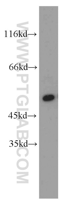 CPSF7 Rabbit anti-Human, Mouse, Rat, Polyclonal, Proteintech:Antibodies:Primary