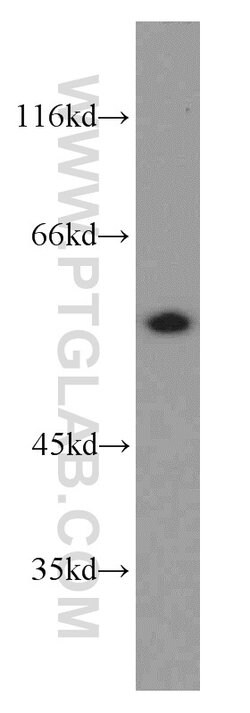 CPSF7 Rabbit anti-Human, Mouse, Rat, Polyclonal, Proteintech:Antibodies:Primary