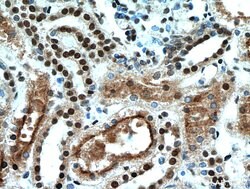 SET Rabbit anti-Human, Mouse, Rat, Polyclonal, Proteintech 150 &mu;L; Unconjugated:Antibodies,
