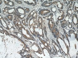 PCSK9 Rabbit anti-Human, Mouse, Rat, Polyclonal, Proteintech:Antibodies:Primary