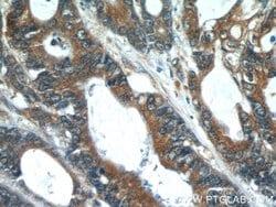PCSK9 Rabbit anti-Human, Mouse, Rat, Polyclonal, Proteintech:Antibodies:Primary