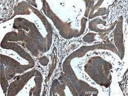 PCSK9 Rabbit anti-Human, Mouse, Rat, Polyclonal, Proteintech:Antibodies:Primary