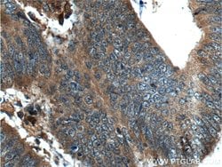 PCSK9 Rabbit anti-Human, Mouse, Rat, Polyclonal, Proteintech:Antibodies:Primary