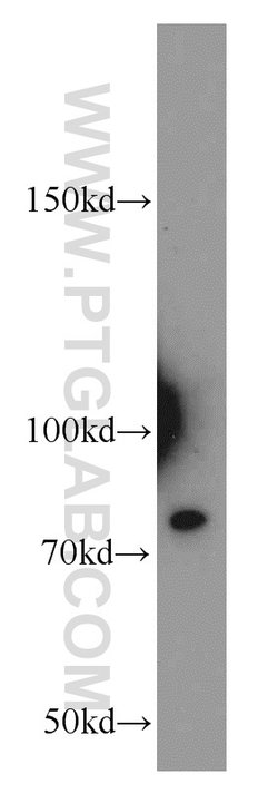 PCSK9 Rabbit anti-Human, Mouse, Rat, Polyclonal, Proteintech:  