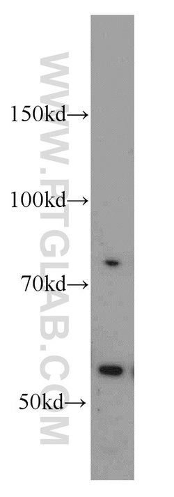 PCSK9 Rabbit anti-Human, Mouse, Rat, Polyclonal, Proteintech:  