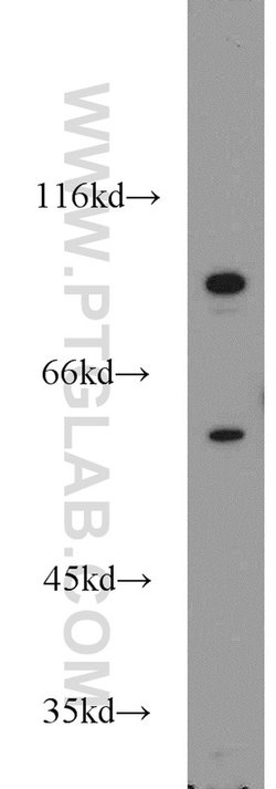 PCSK9 Rabbit anti-Human, Mouse, Rat, Polyclonal, Proteintech:  