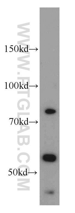 PCSK9 Rabbit anti-Human, Mouse, Rat, Polyclonal, Proteintech:  