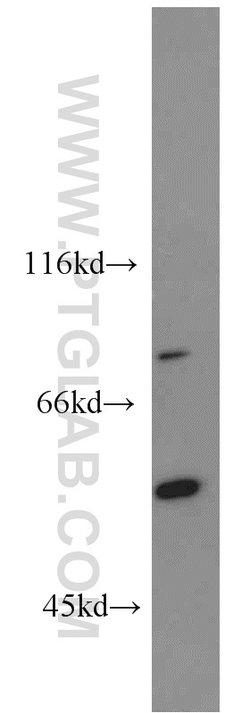 PCSK9 Rabbit anti-Human, Mouse, Rat, Polyclonal, Proteintech:  