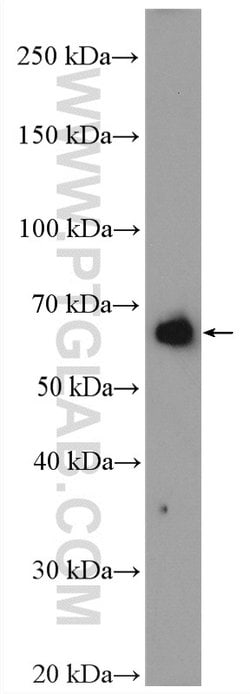 PCSK9 Rabbit anti-Human, Mouse, Rat, Polyclonal, Proteintech:  